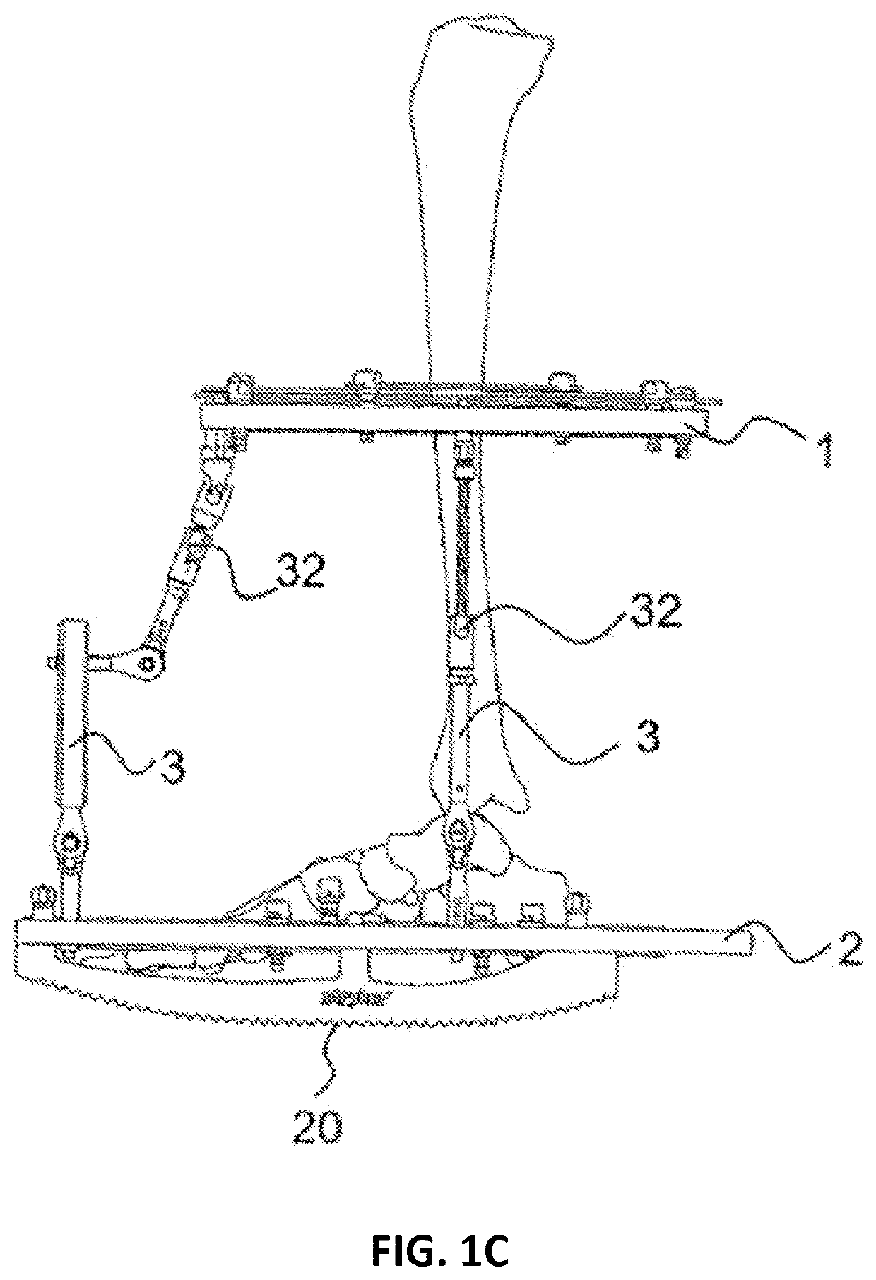 External fixator system