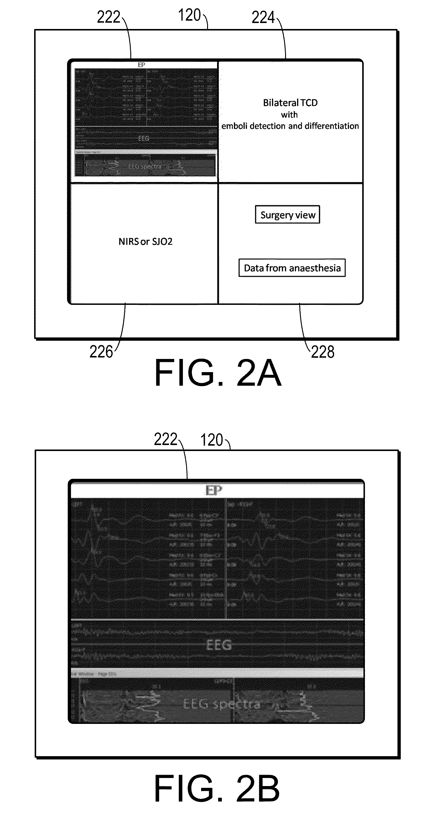 Integrated multimodality brain monitoring device