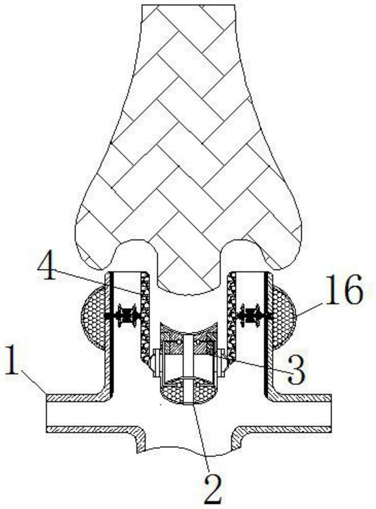 A lung exhalation training device for nursing patients in cardiothoracic surgery