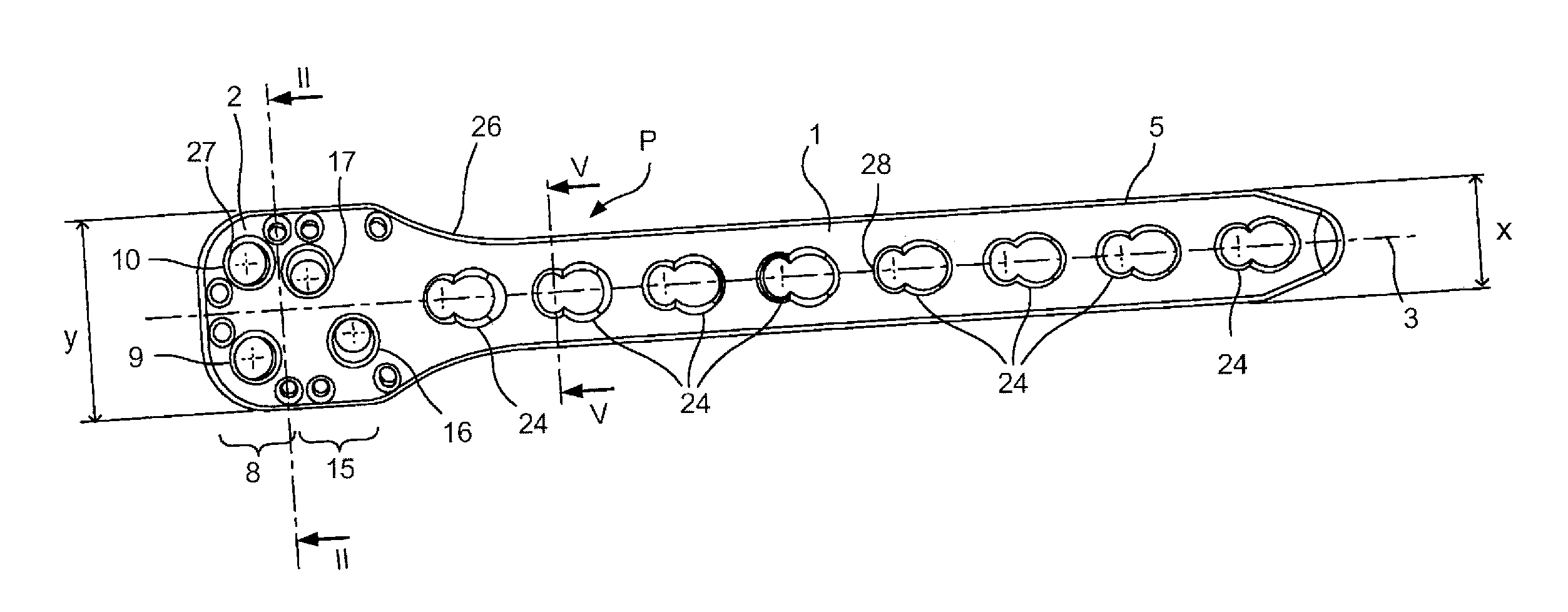 Bone Plate