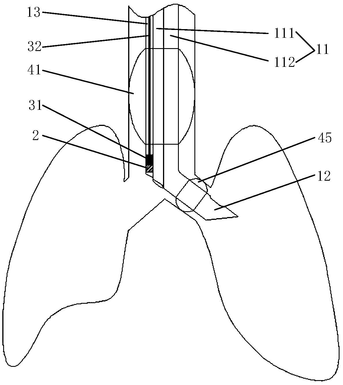 Double-cavity bronchial cannula