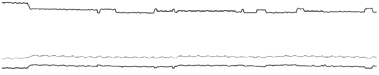 Non-contact physiological parameter detection method, system and device