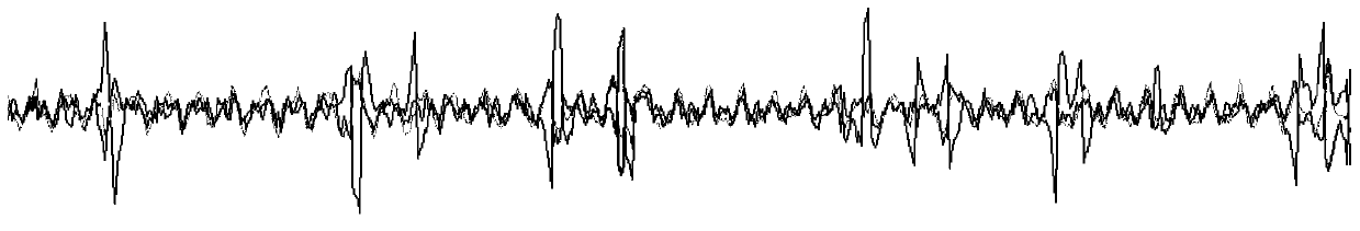 Non-contact physiological parameter detection method, system and device