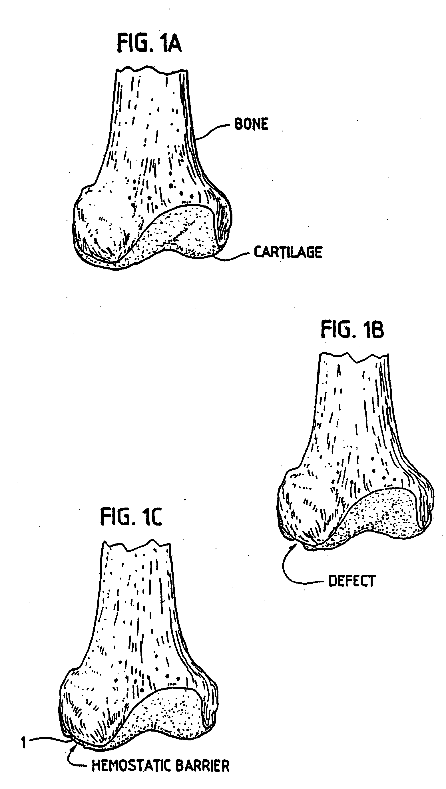 Method for autologous transplantation