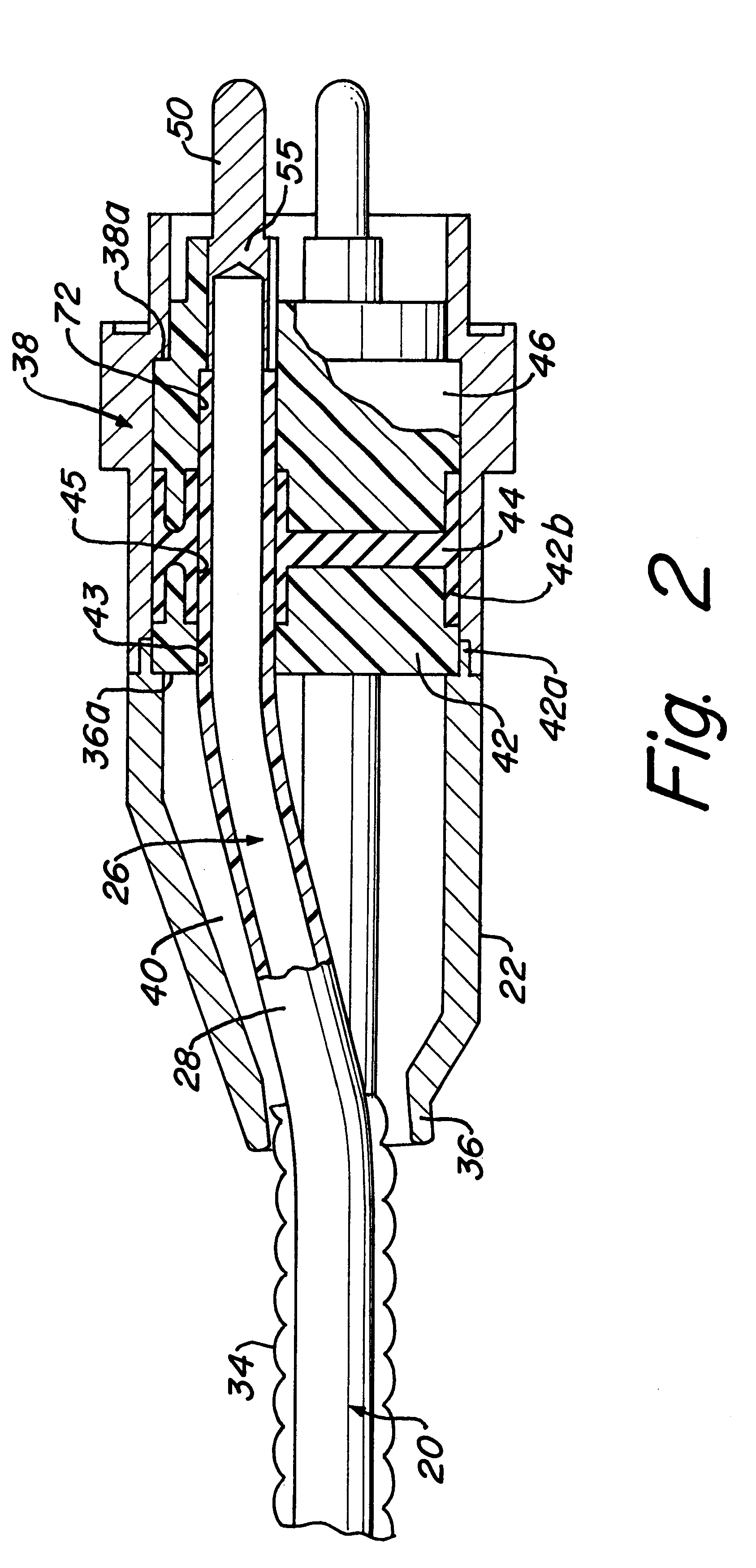 Pothead with pressure energized lip seals