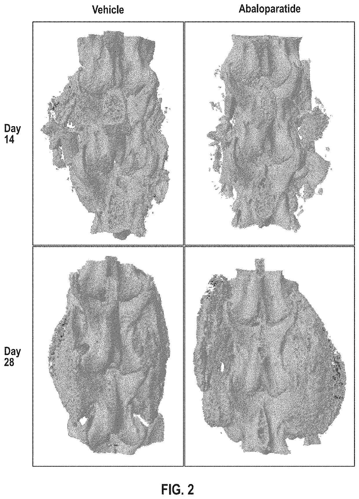 Methods of improving spinal fusion with abaloparatide