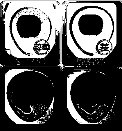 Method for automatically scoring excrement picture before colonoscopy detection