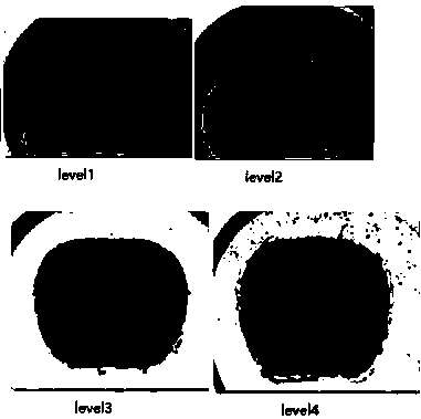 Method for automatically scoring excrement picture before colonoscopy detection