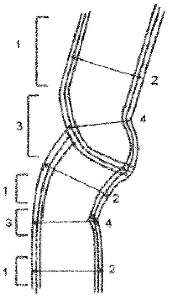 Undercoat layer-forming composition for energy storage device