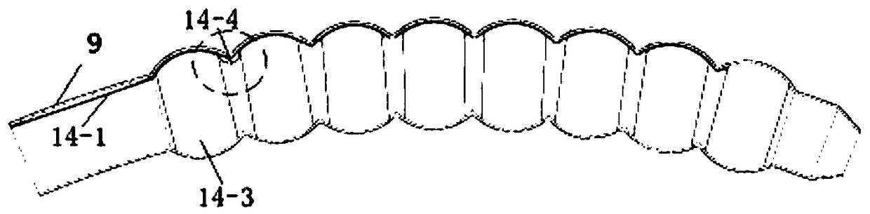 Novel controllable-orientation intestinal obstruction treatment device