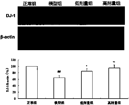 Application of protocatechualdehyde in the treatment of male infertility and in vitro treatment of sperm