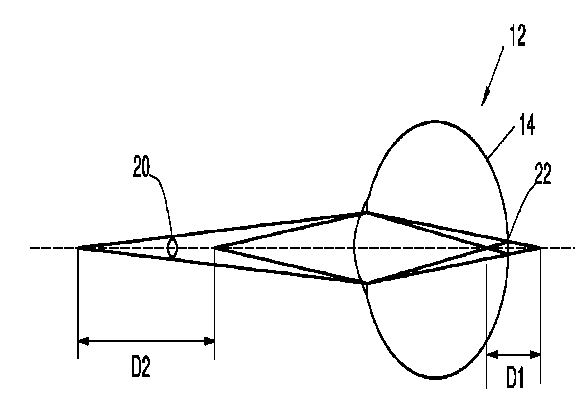 Method of treating myopia progressions