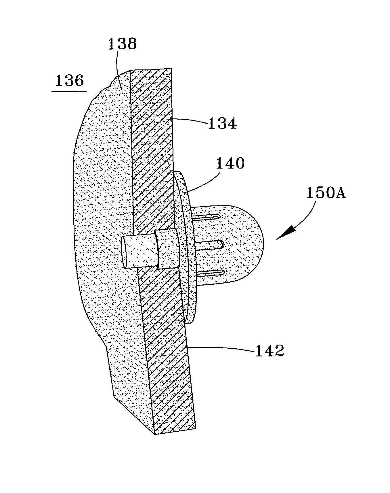 Minimally-invasive procedures for monitoring physiological parameters within internal organs and anchors therefor