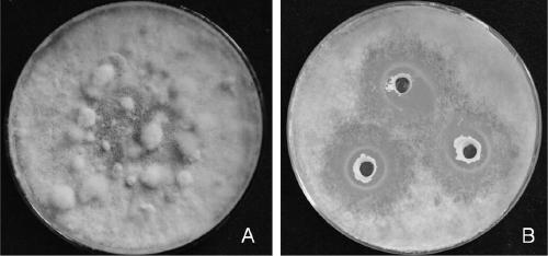 Bacillus siamensis YJ15 and application thereof