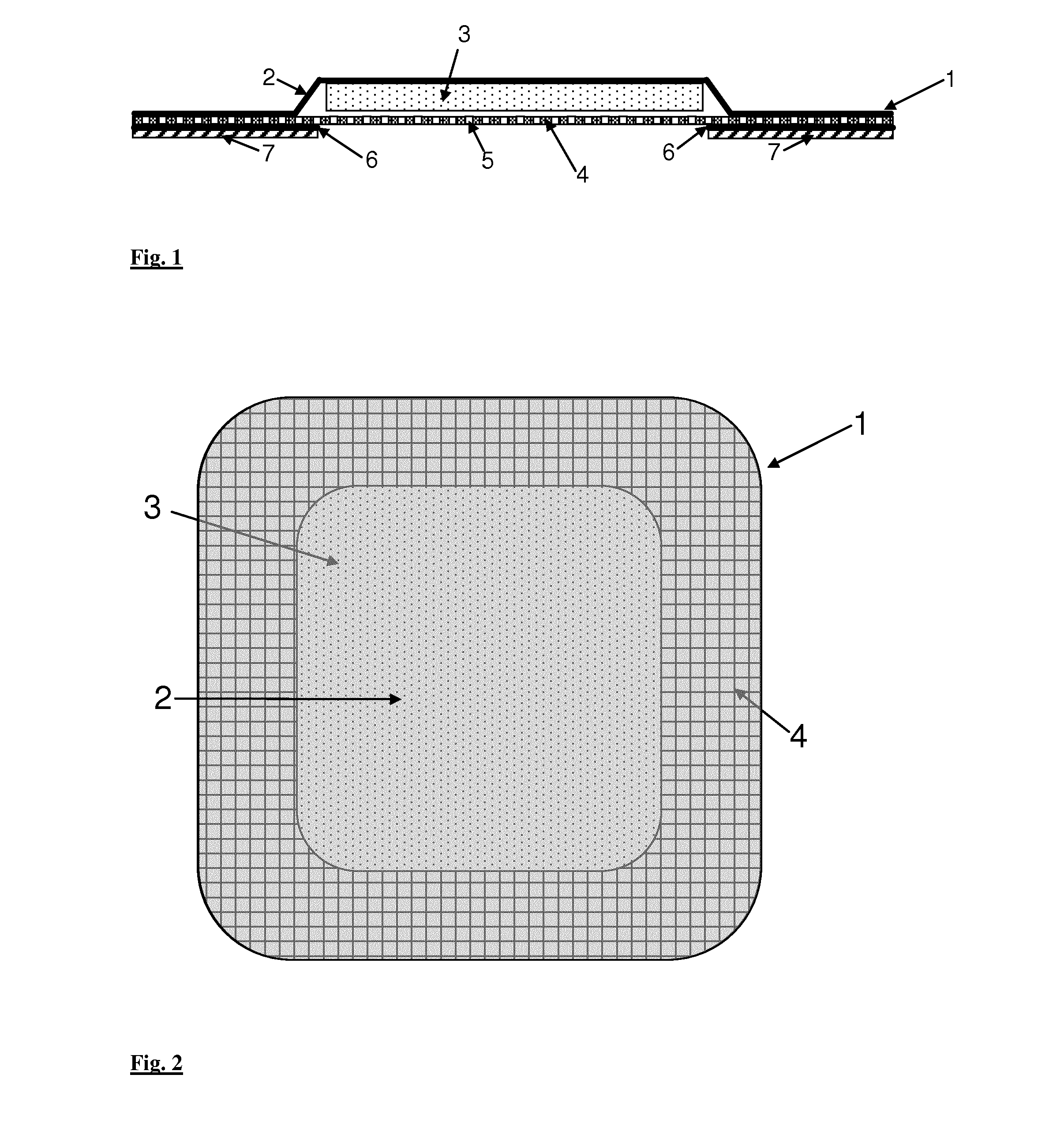 Wound dressing