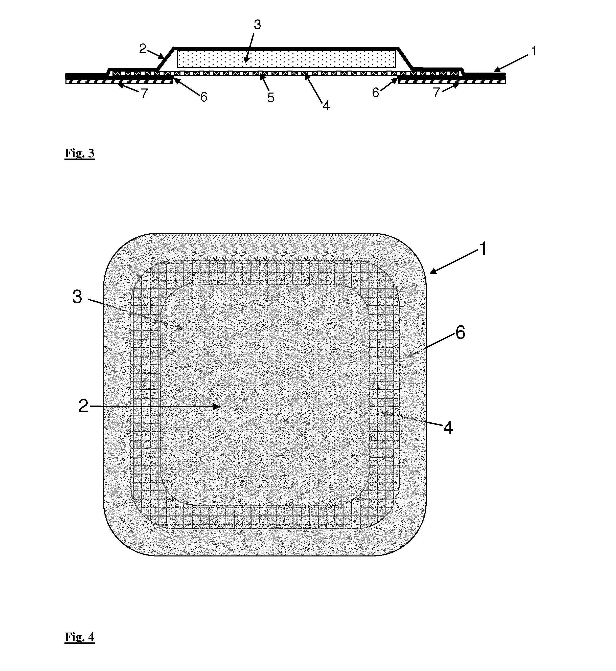 Wound dressing