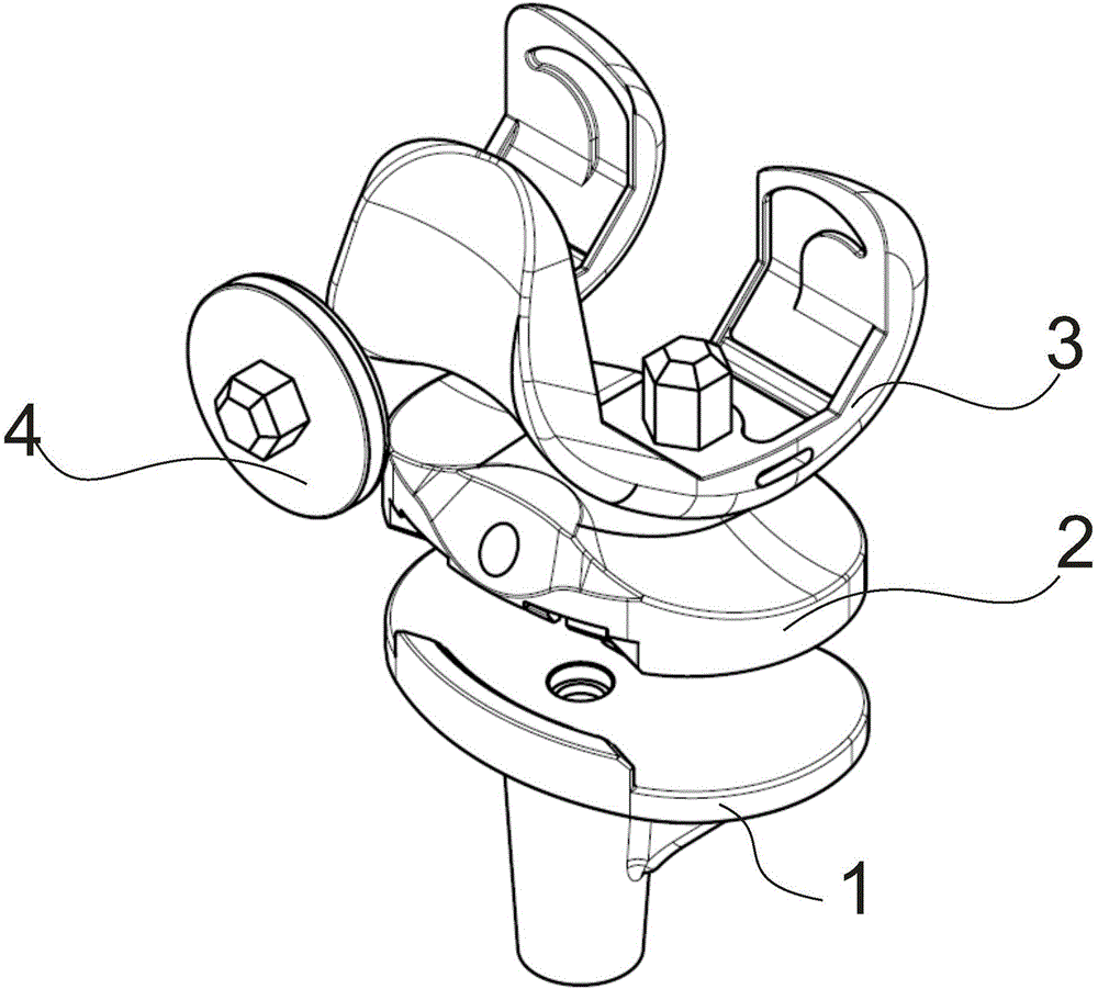 Bone induction differentiated metal bone trabecula knee joint prosthesis and preparation method thereof