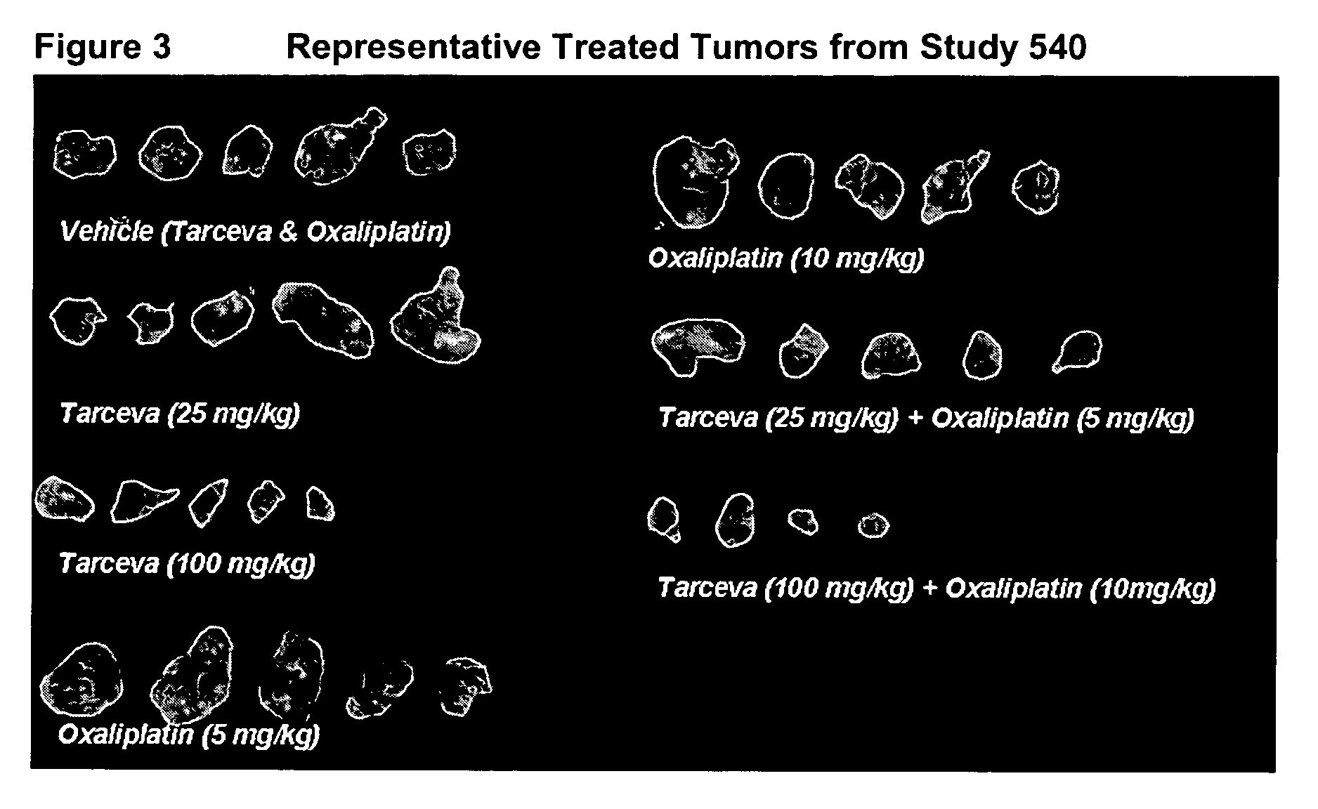 Combined treatment with oxaliplatin and an epidermal growth factor receptor kinase inhibitor