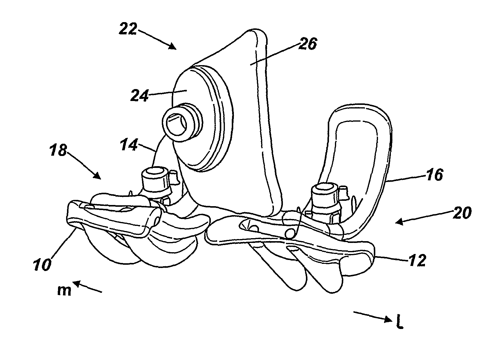 Modular knee implants