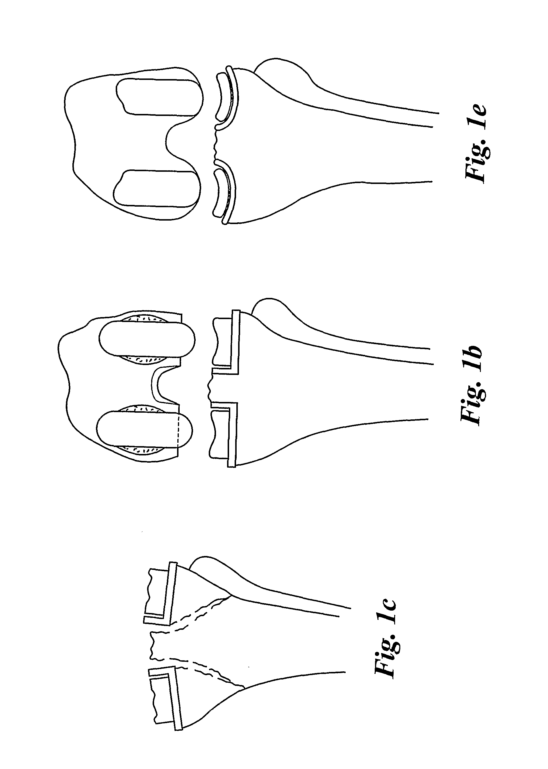 Modular knee implants