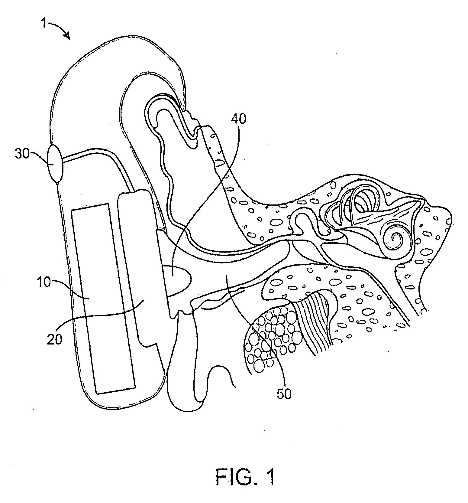 Optical ear infection treatment device and method