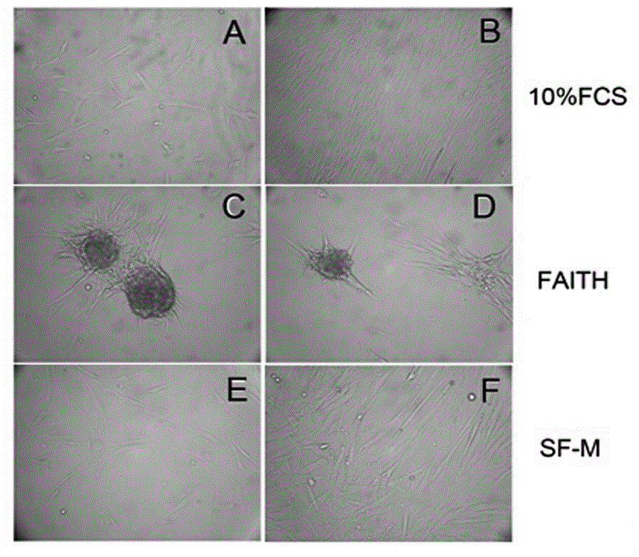 Culture medium for culturing mesenchymal stem cells