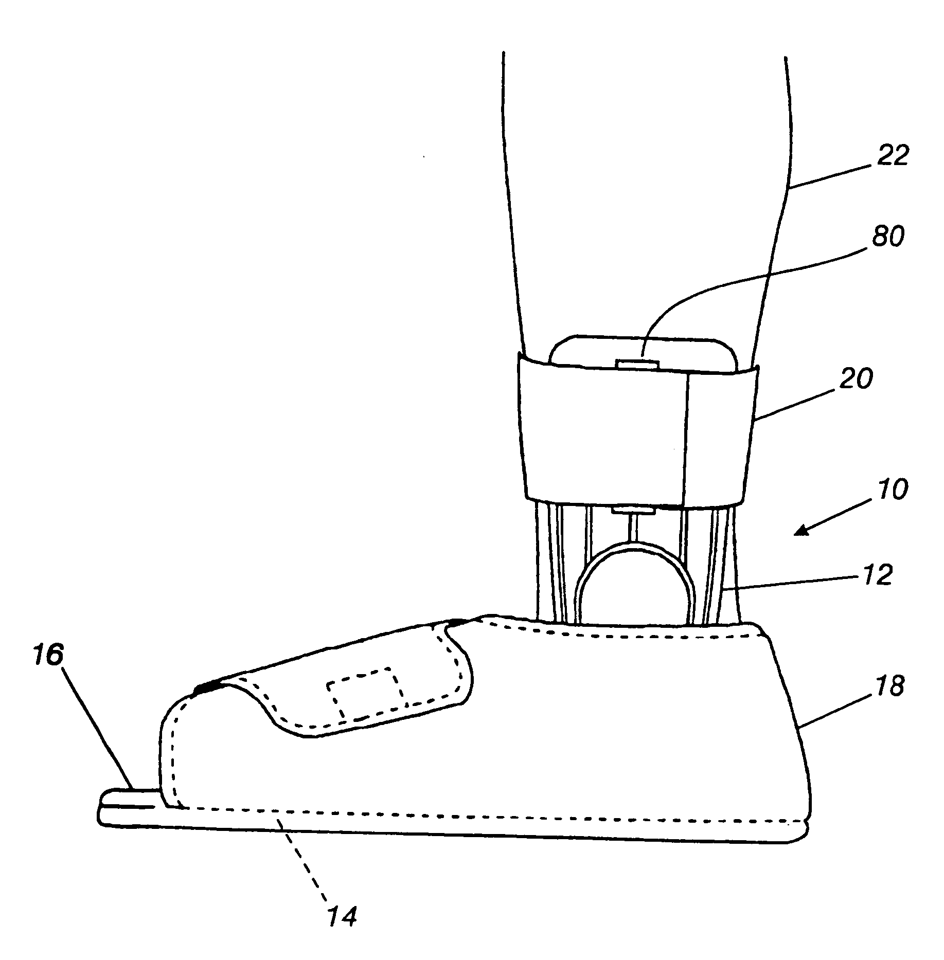 Orthopedic night foot splint