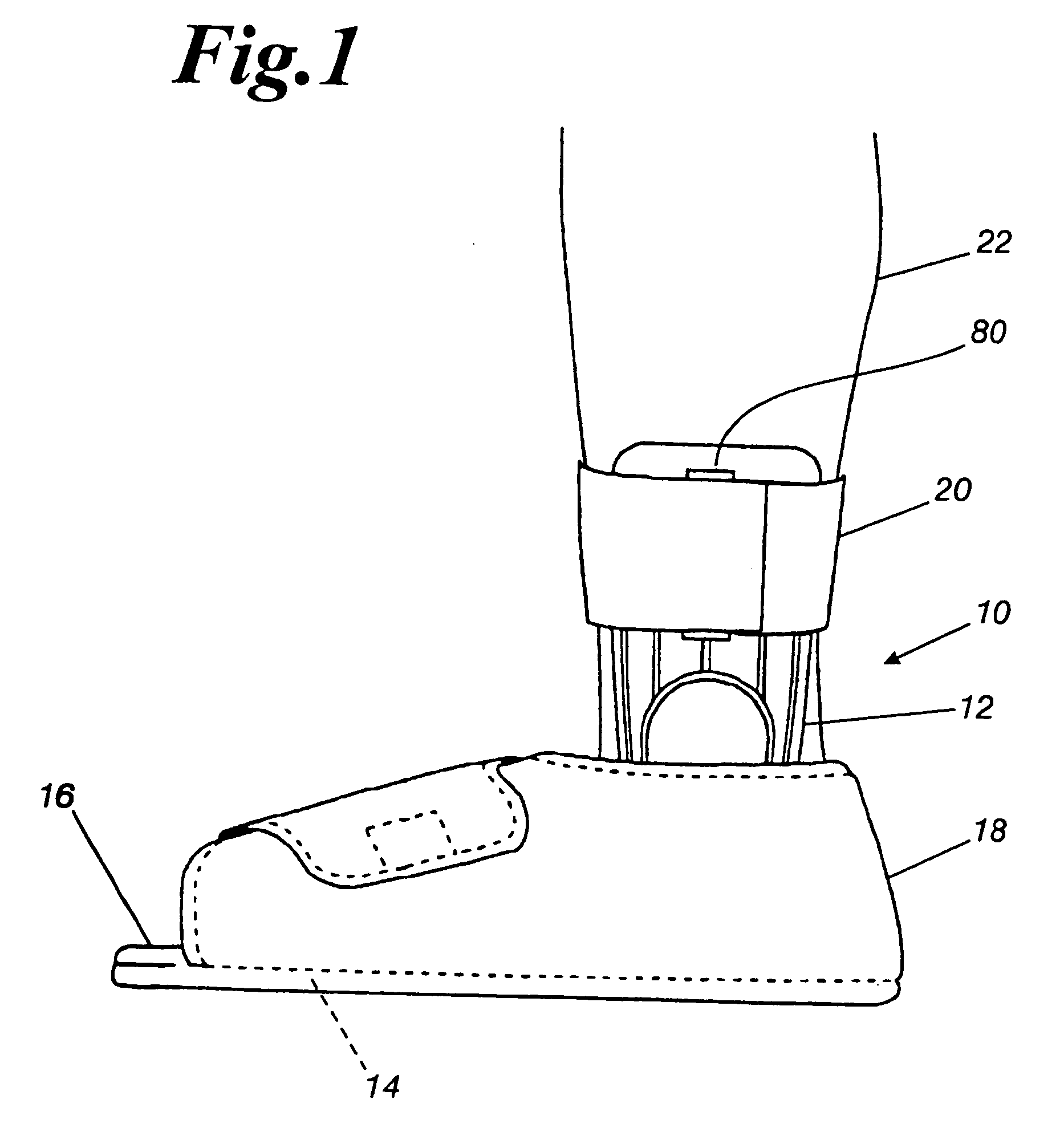 Orthopedic night foot splint