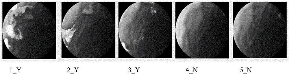 Capsule endoscopy image retrieval method based on visual vocabularies and local descriptors