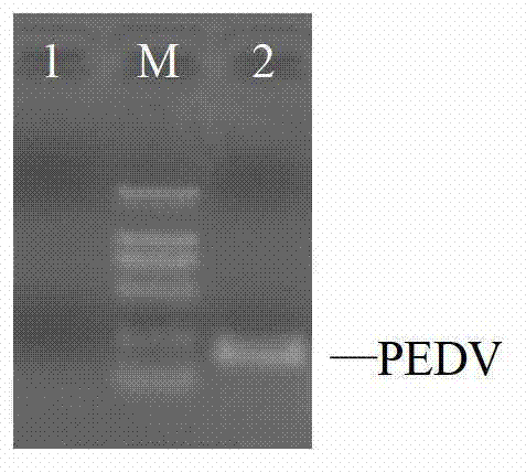 Porcine transmissible gastroenteritis and epidemic diarrhea combined live vaccine and preparation method thereof