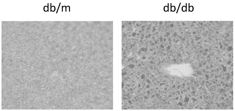 Novel application of inhibitor of hsd17b13 protein or its coding gene