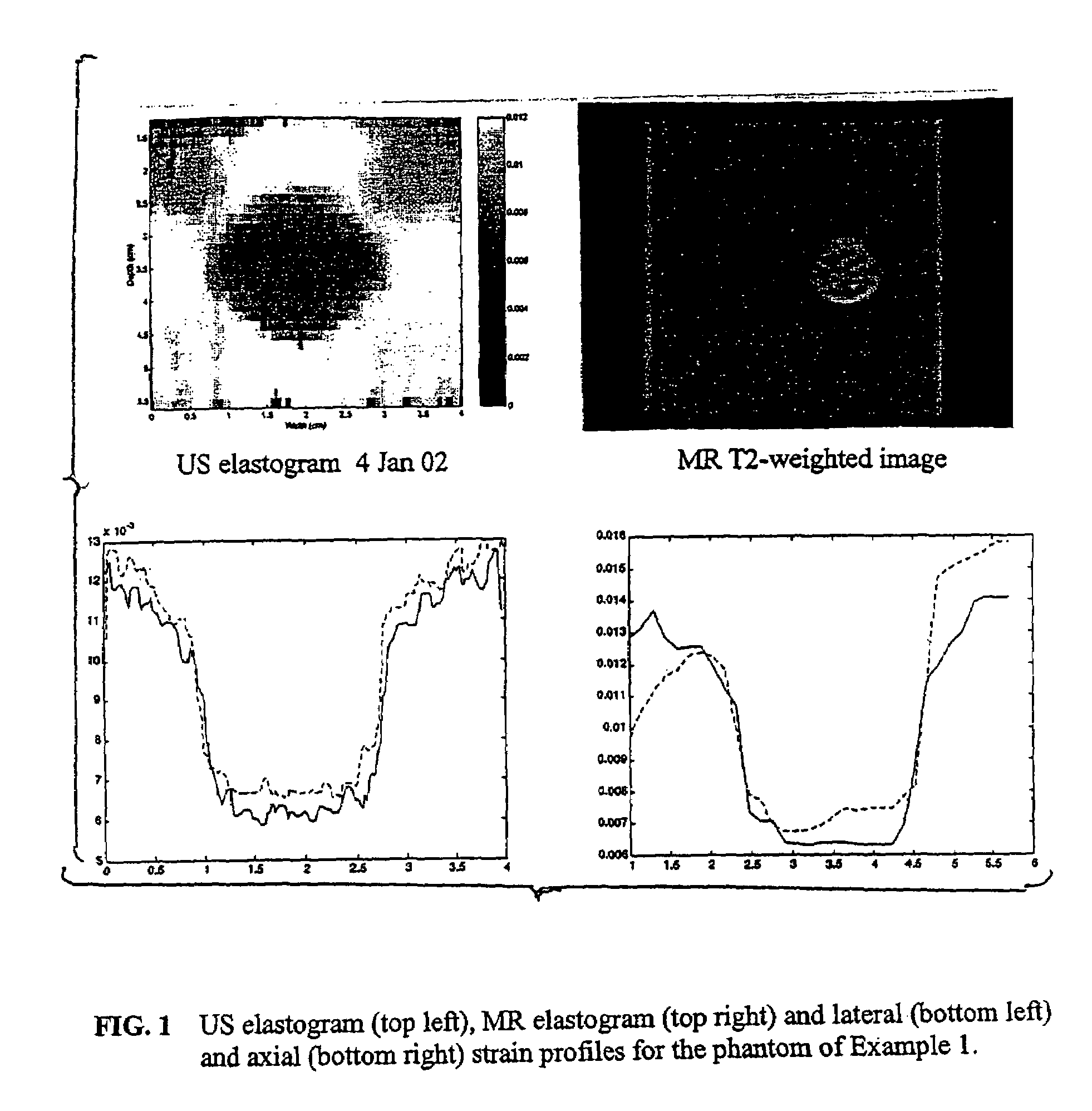 Tissue mimicking elastography phantoms