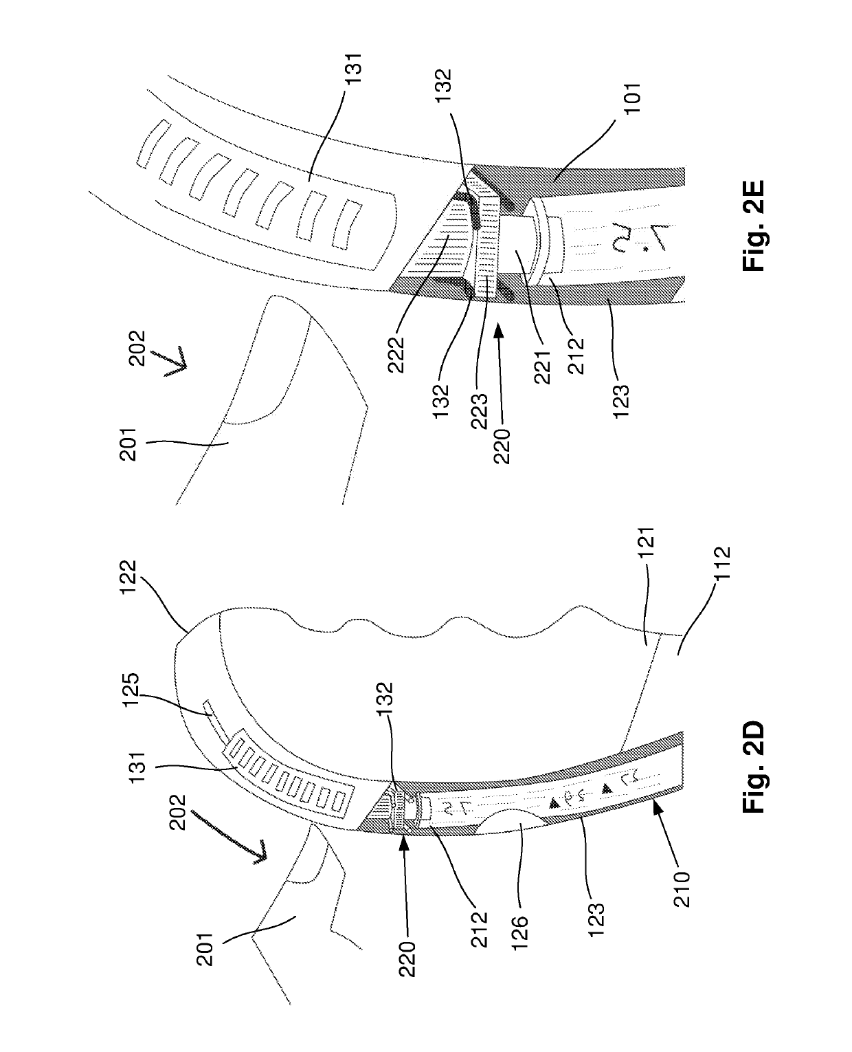 Intubation device