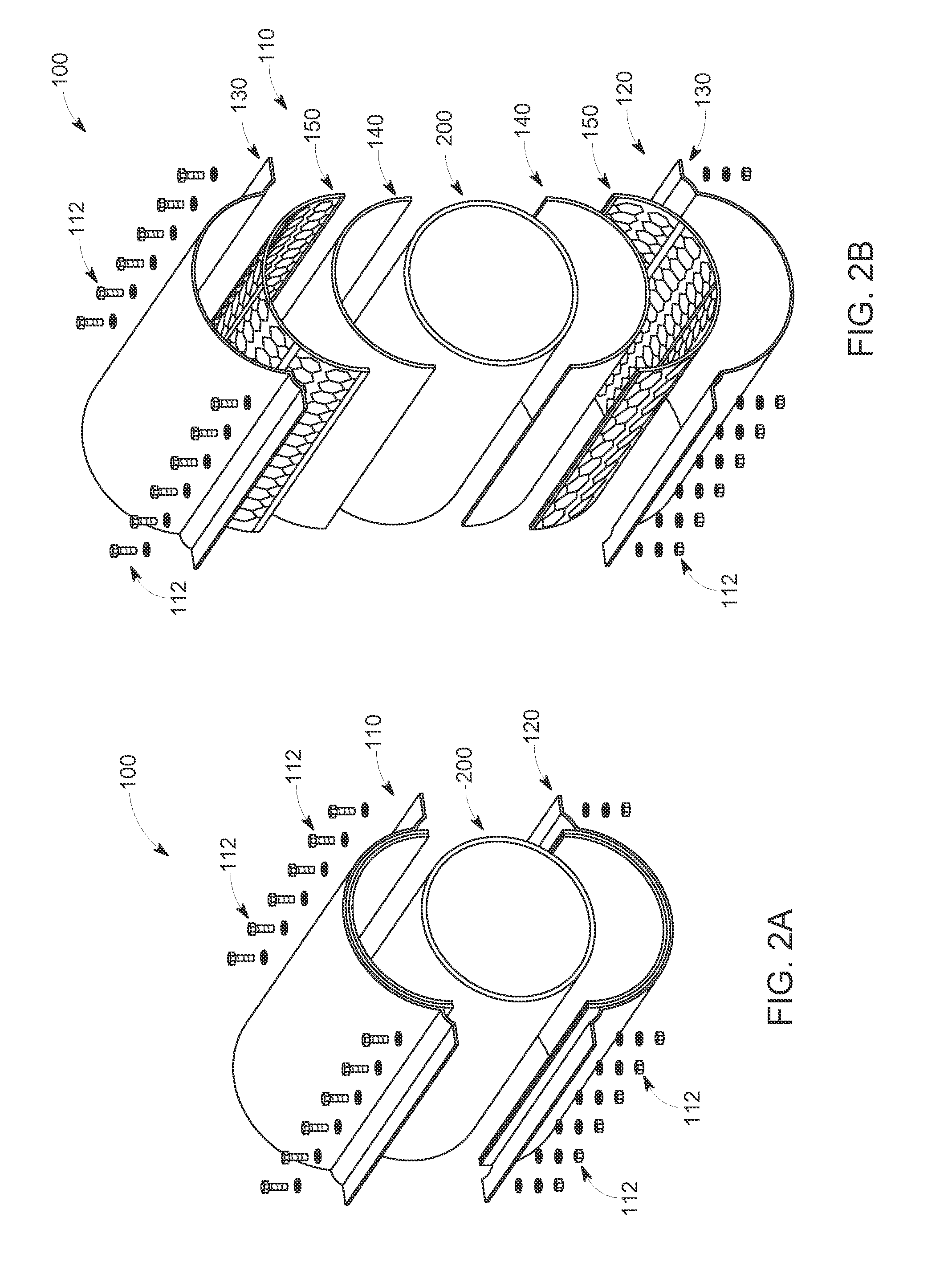 Integrated pipeline protection system