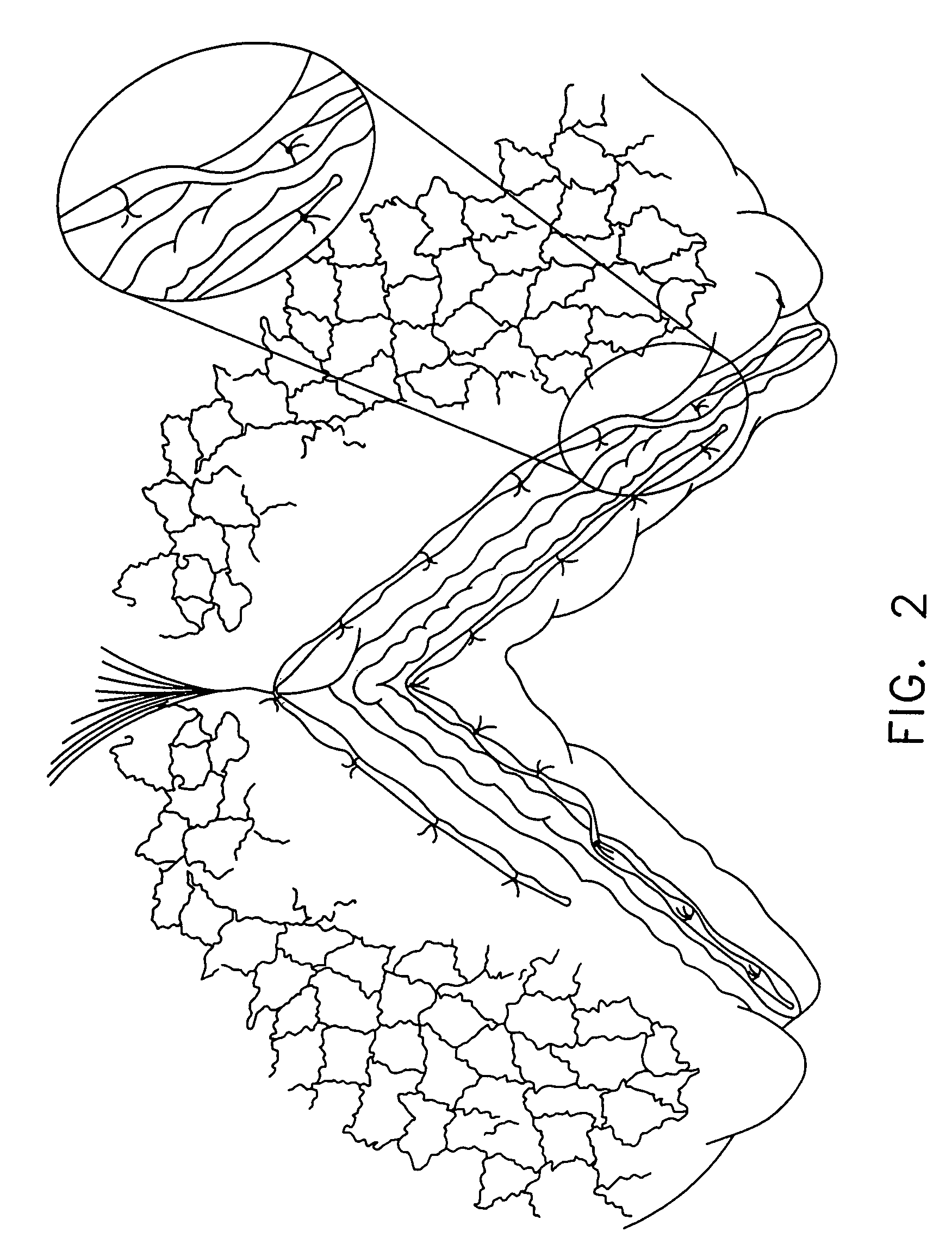 Radioactive therapeutic apparatus