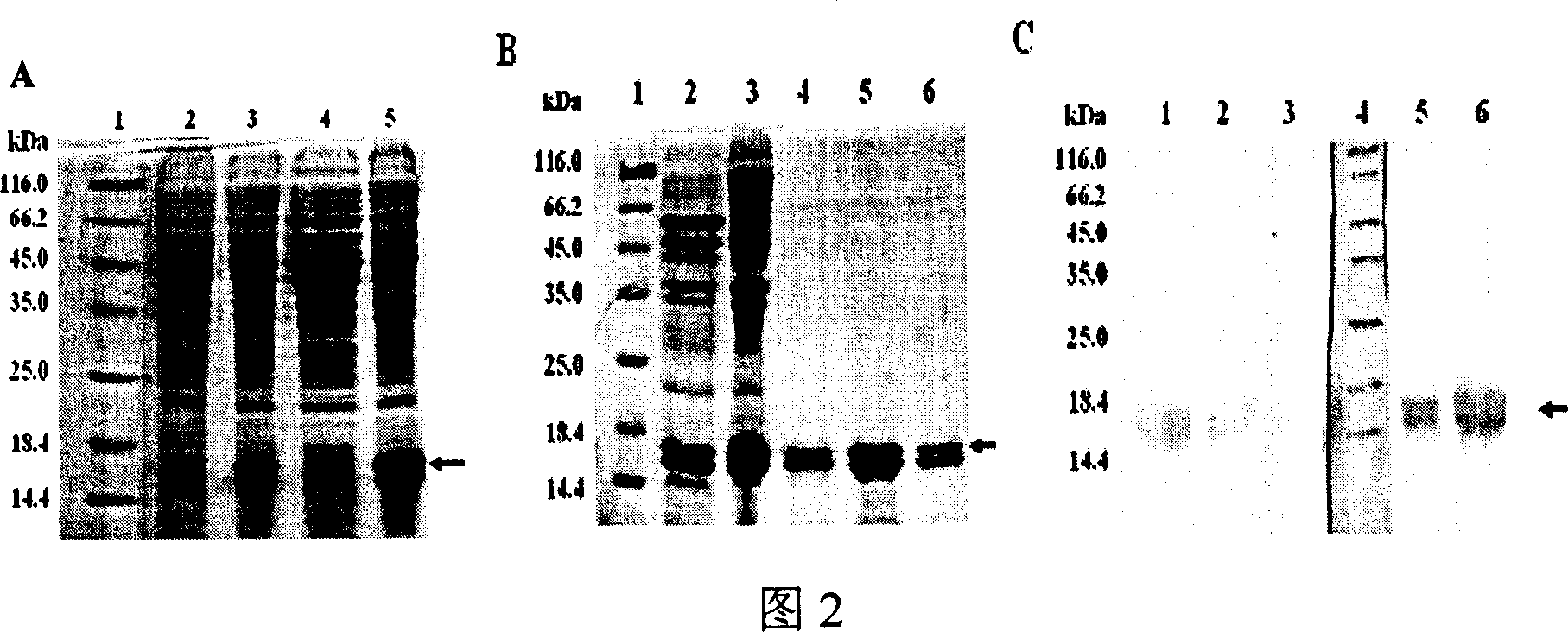 Therapeutic vaccine for Myostatin specific antibody and its preparation method