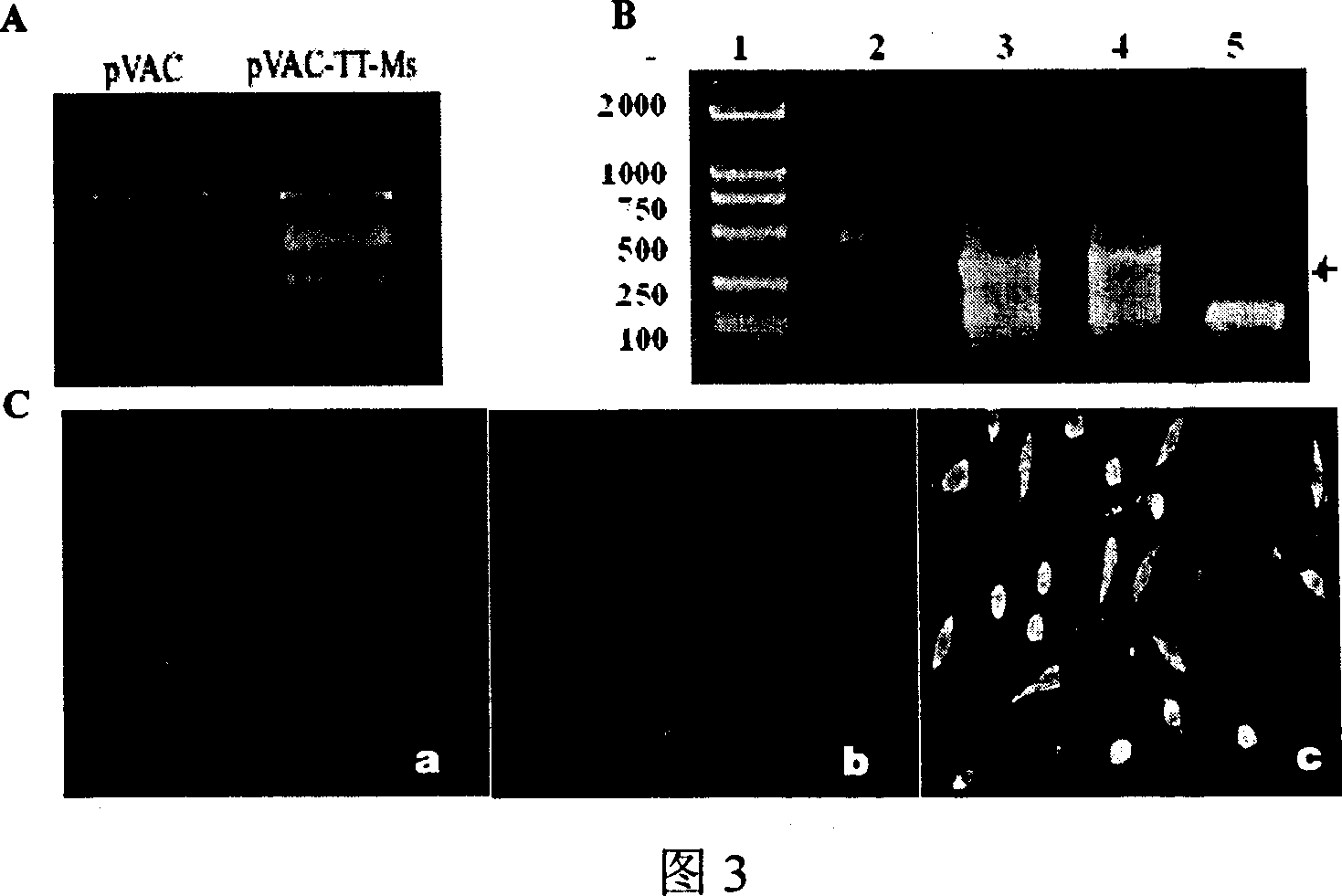 Therapeutic vaccine for Myostatin specific antibody and its preparation method