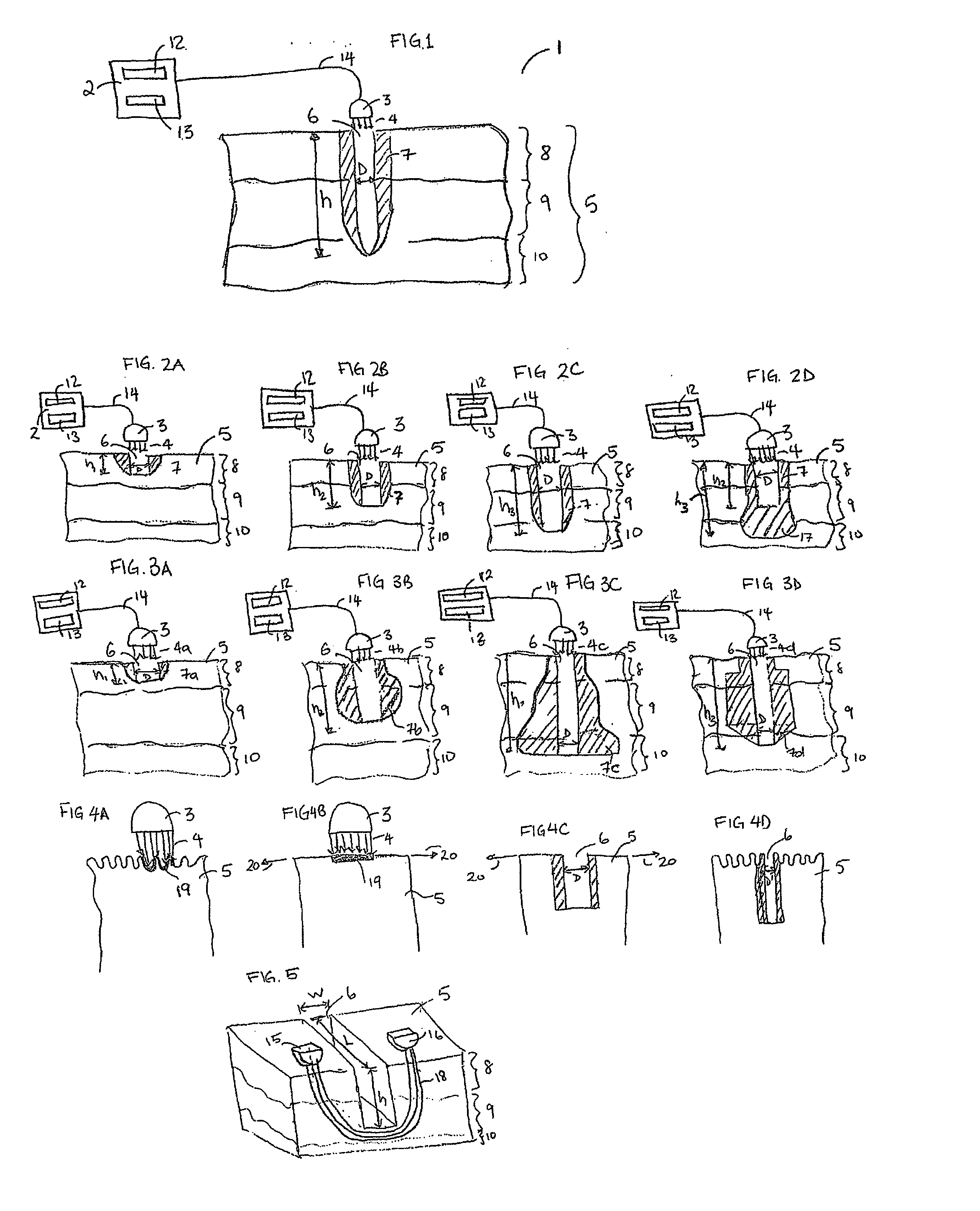 System and method for microablation of tissue