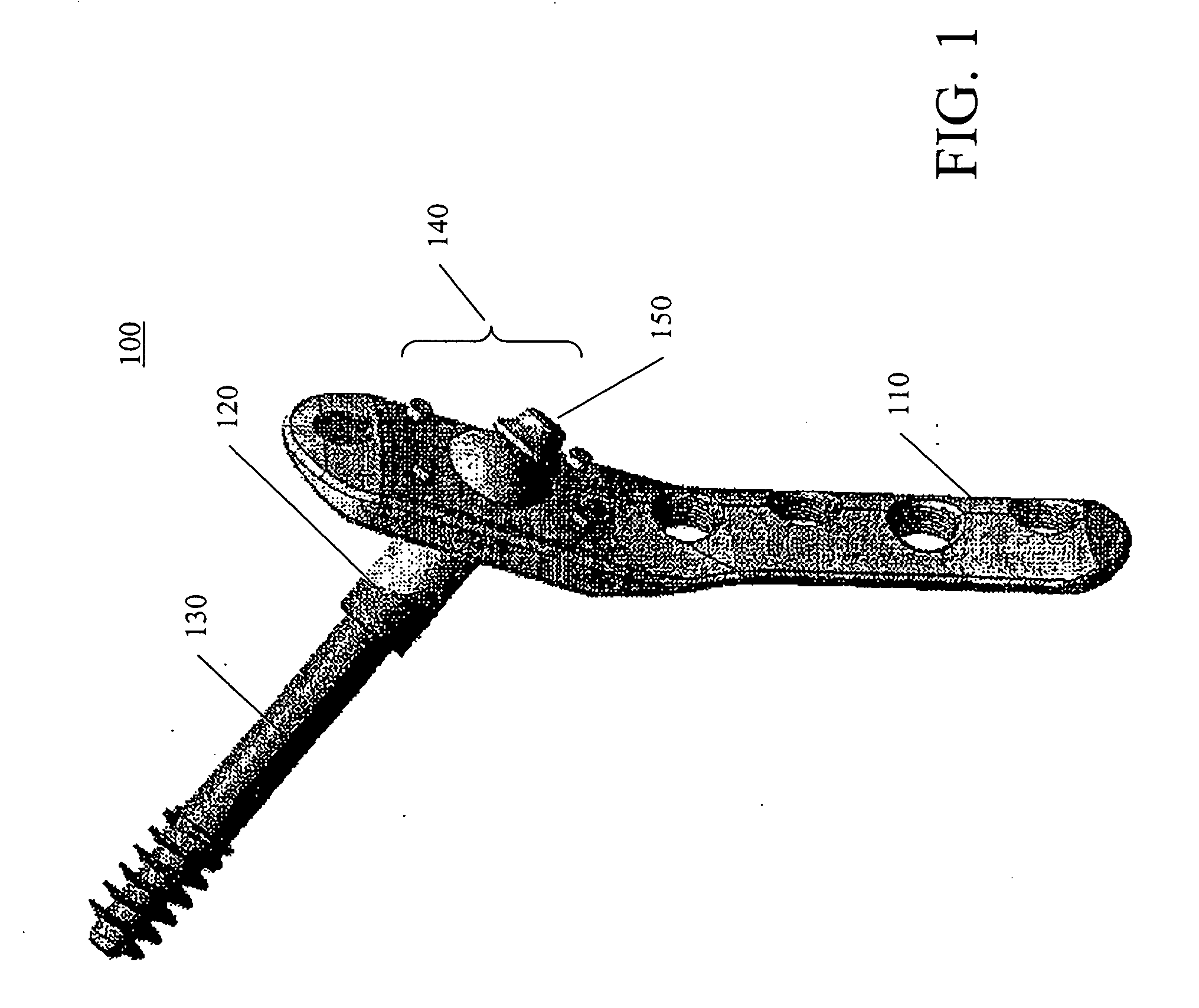 Methods for treating fractures of the femur and femoral fracture devices