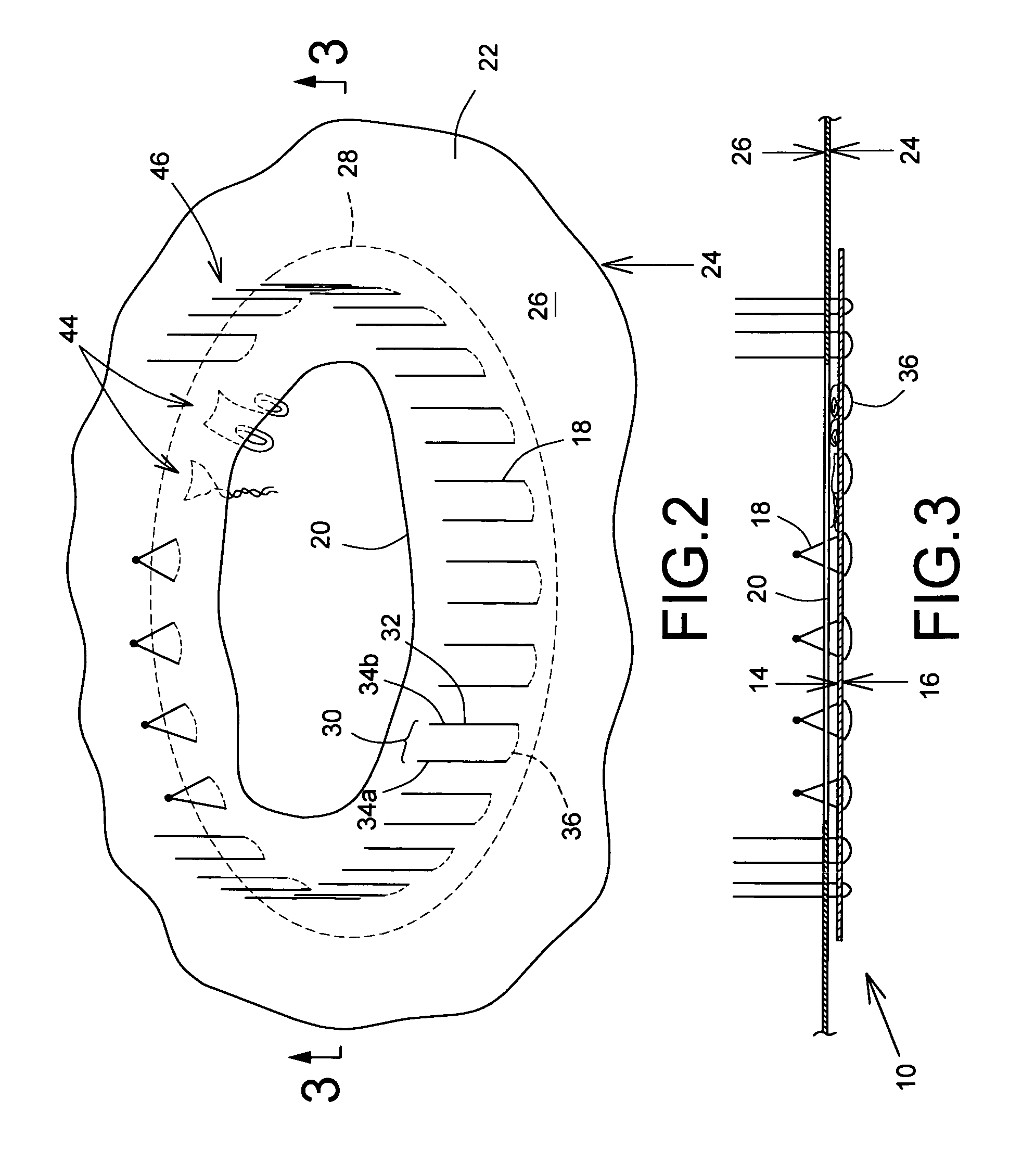 Prosthetic repair patch with integrated sutures and method therefor