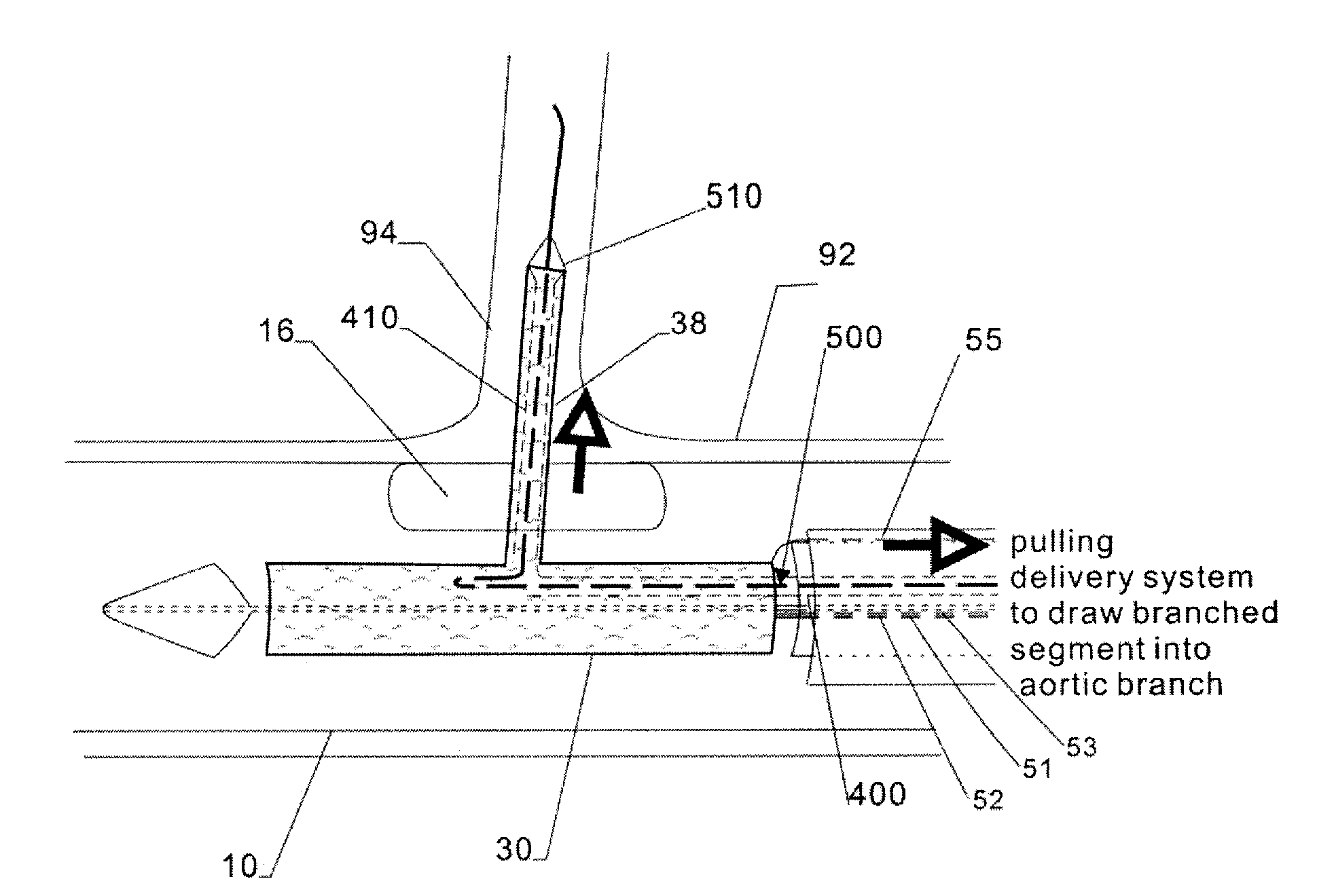 Modular stent graft and delivery system