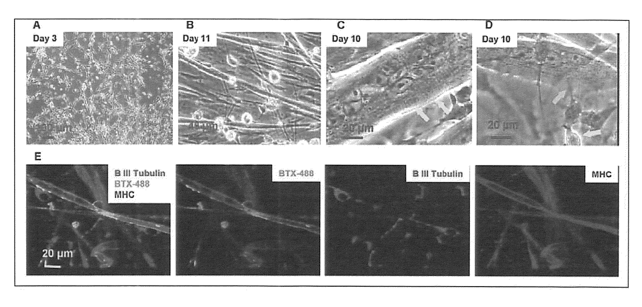 Formation of neuromuscular junctions in a defined system