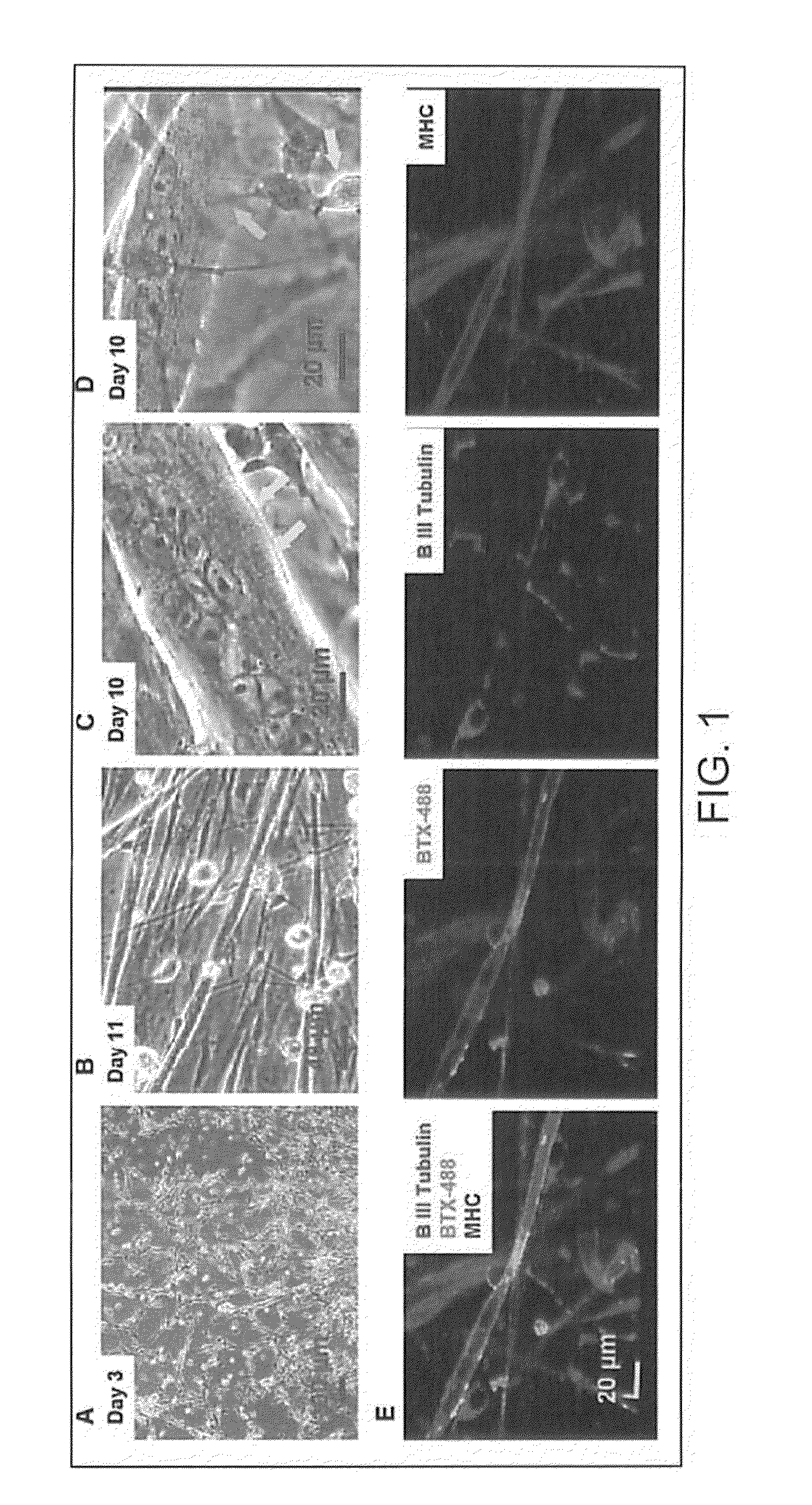 Formation of neuromuscular junctions in a defined system