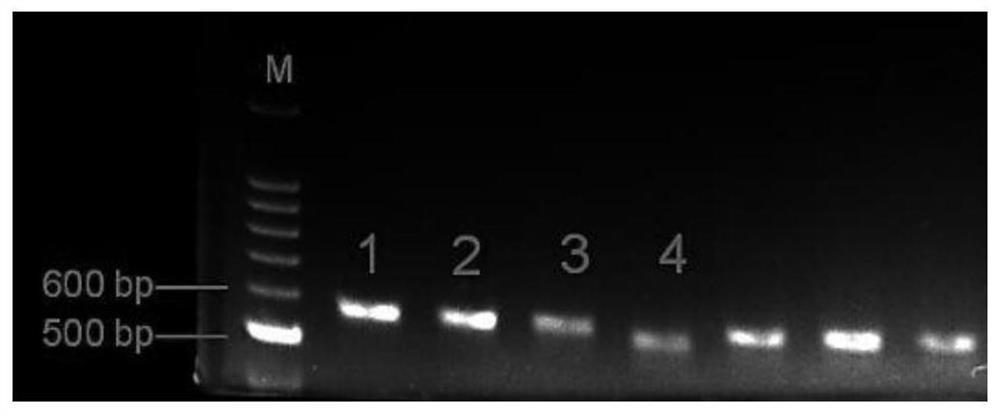 A kind of shRNA that inhibits the expression of hsa_circ_0001610 and its expression vector