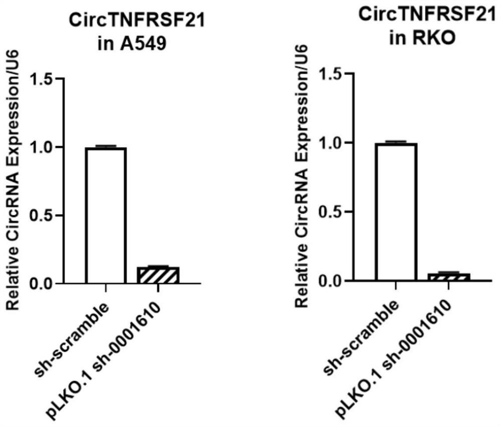 A kind of shRNA that inhibits the expression of hsa_circ_0001610 and its expression vector