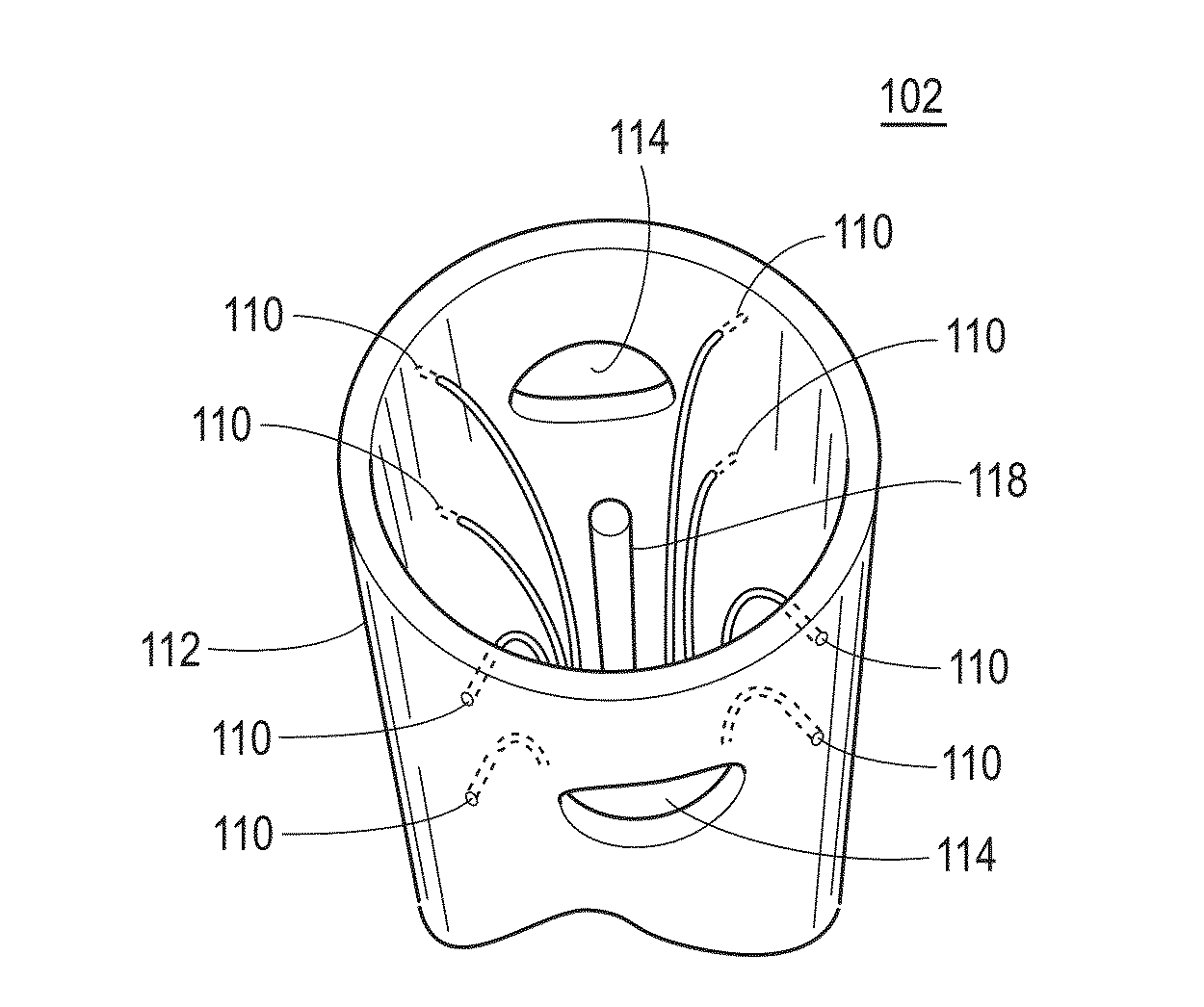 Catheter and method to localize ectopic and reentrant activity in the heart