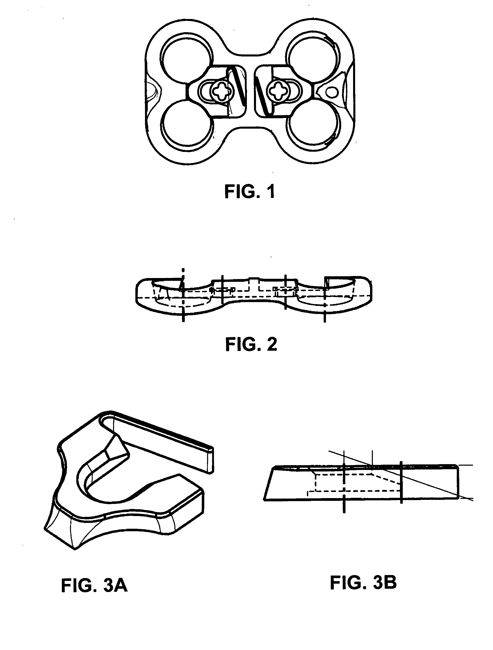 Bone fixation plate