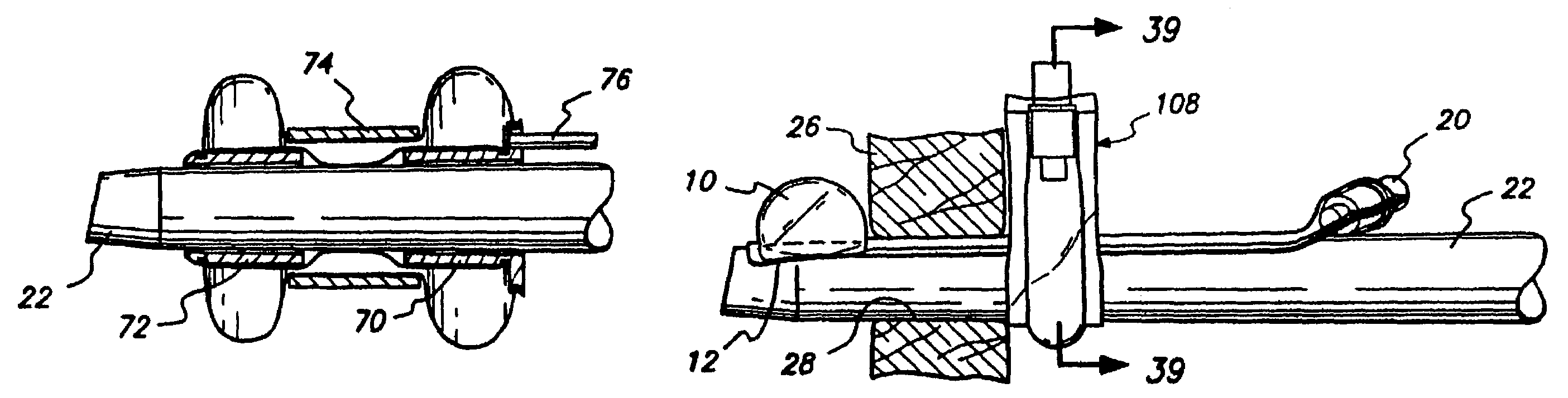 Method and apparatus for anchoring laparoscopic instruments