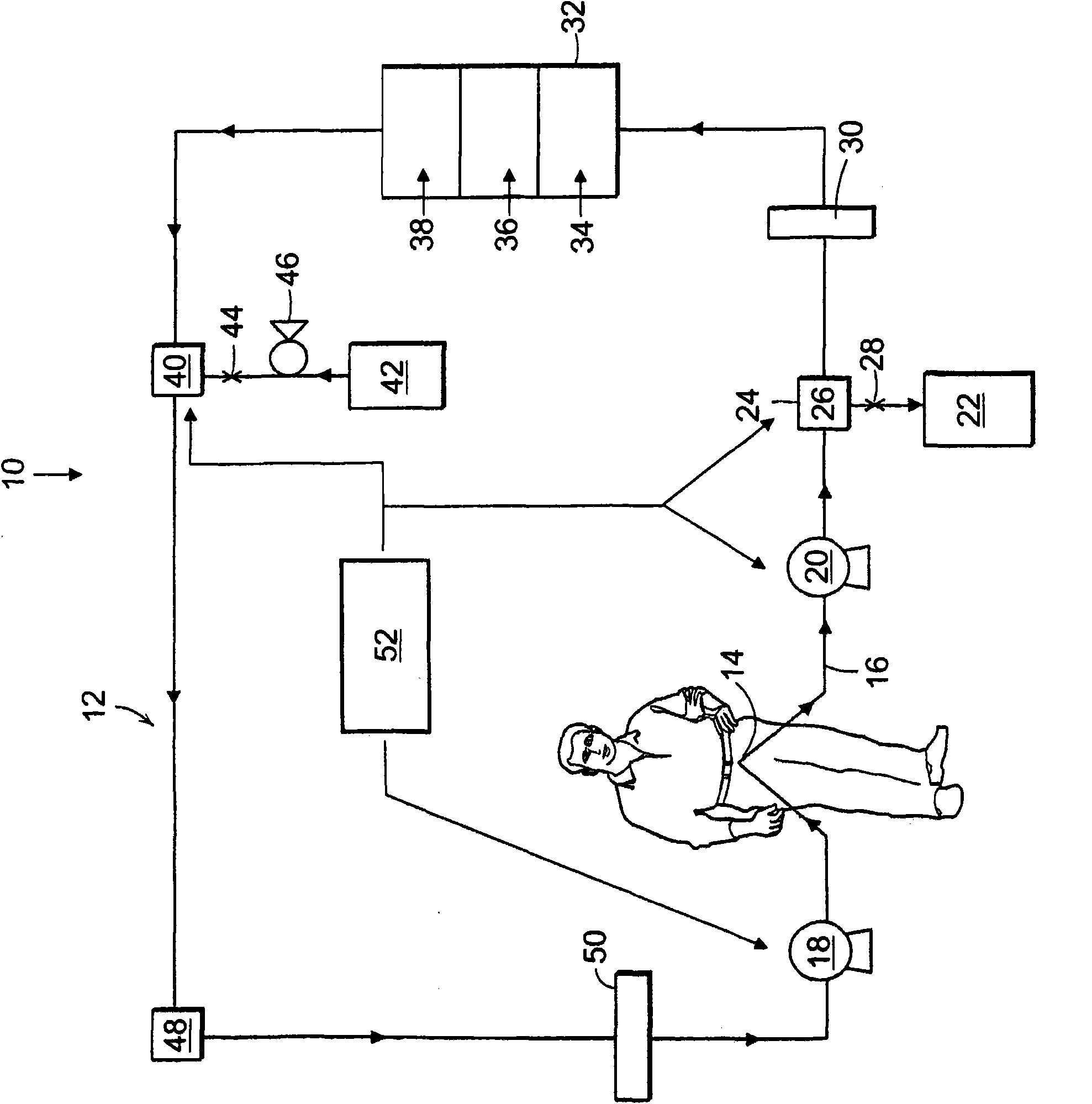 Artificial kidney dialysis system