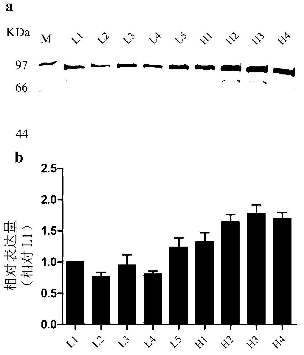 Expression system of fusion protein from human serum albumin and interleukin-1 receptor antagonist